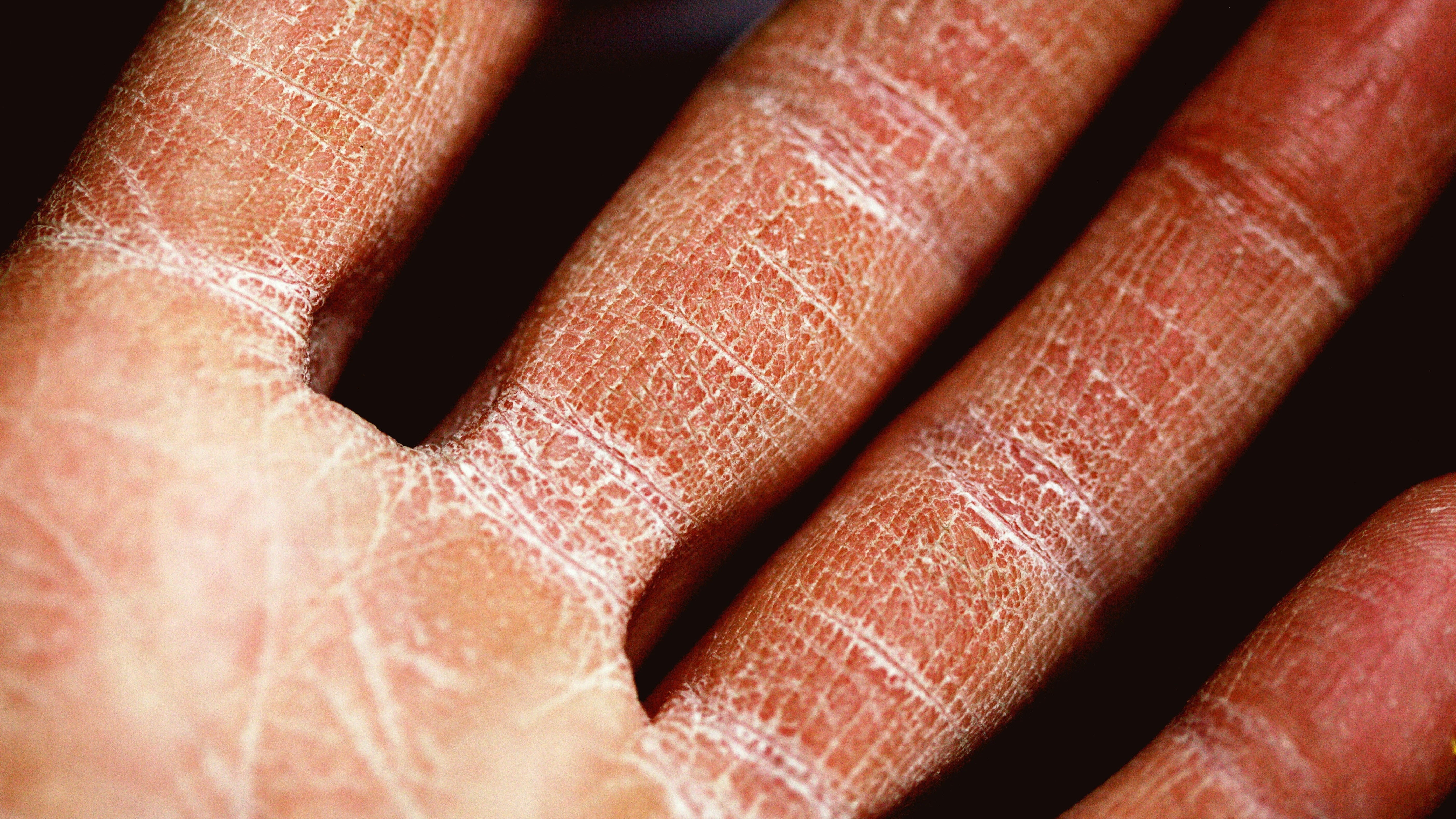 Introducción al Skin Fasting: Desmitificando la Tendencia